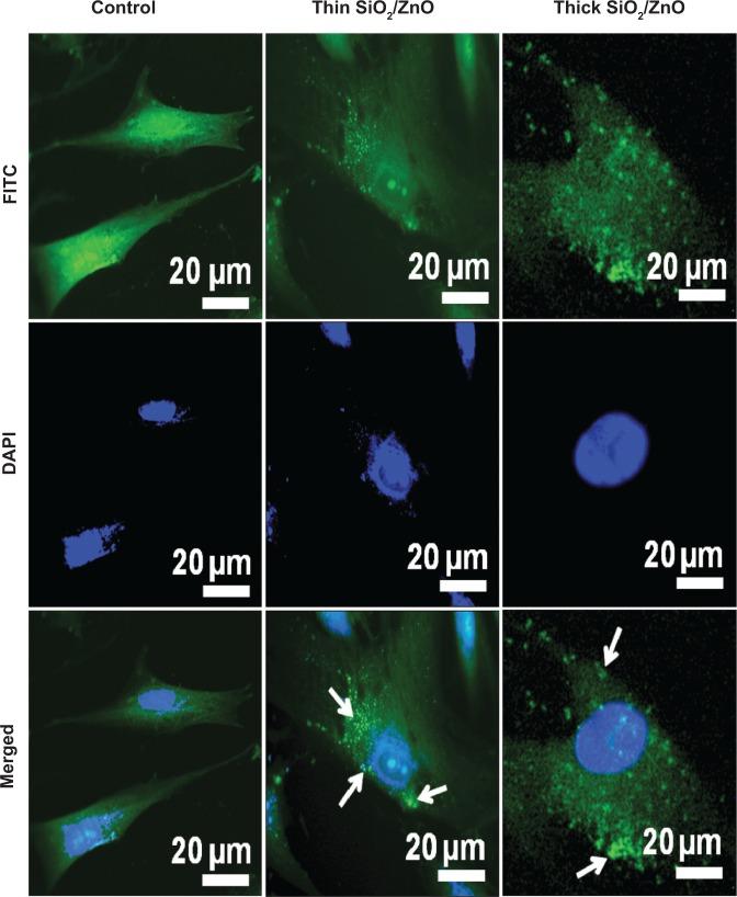 https://cdn.ncbi.nlm.nih.gov/pmc/blobs/8988/4132217/8d7d9ceffb38/ijn-9-3707Fig3.jpg