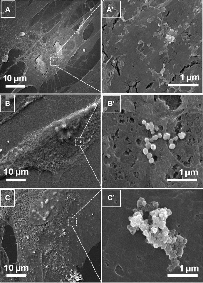 https://cdn.ncbi.nlm.nih.gov/pmc/blobs/8988/4132217/d443c5053f0a/ijn-9-3707Fig4.jpg