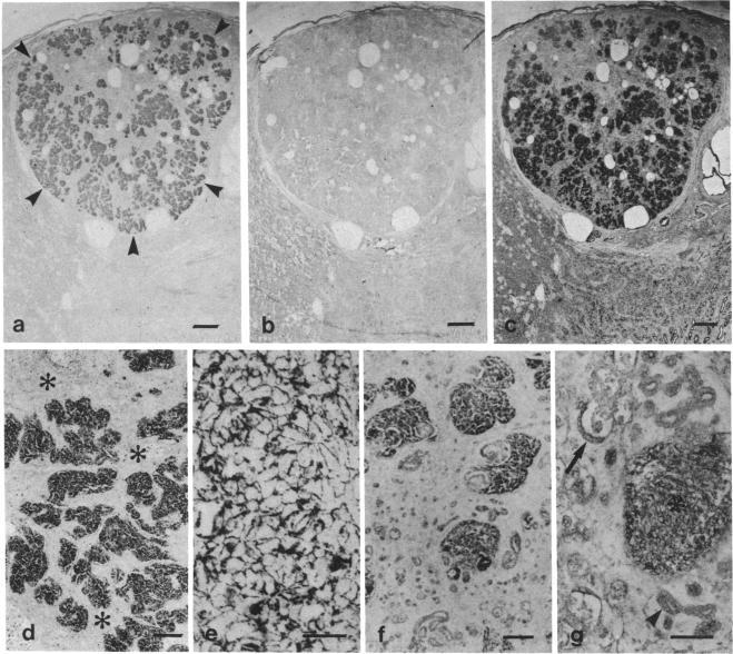 https://cdn.ncbi.nlm.nih.gov/pmc/blobs/8989/280130/78612328c955/pnas00261-0130-a.jpg