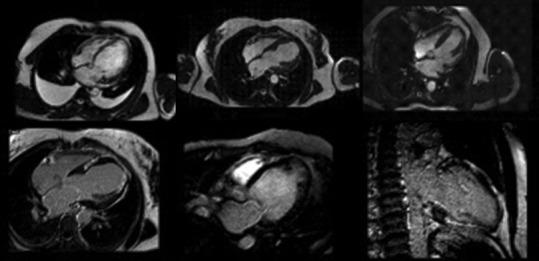 https://cdn.ncbi.nlm.nih.gov/pmc/blobs/8995/12129275/dc35a4b5a19f/JCE-35-8-g009.jpg
