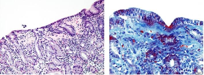 https://cdn.ncbi.nlm.nih.gov/pmc/blobs/899c/5412546/6e42d67ba14b/gr-10-126-g001.jpg