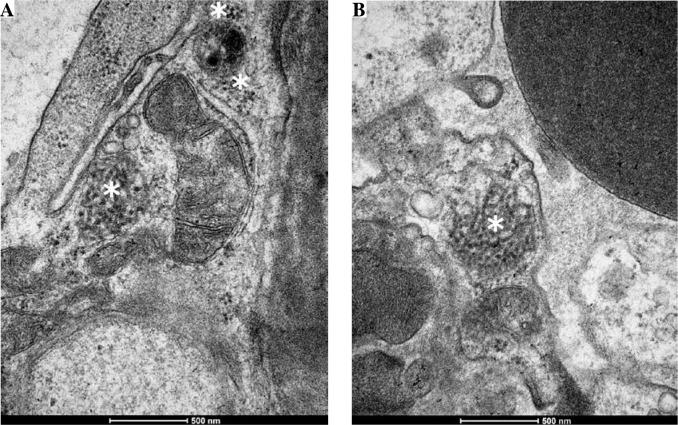 https://cdn.ncbi.nlm.nih.gov/pmc/blobs/89a0/9894092/4ecff24db8fa/CEJI-47-47398-g001.jpg