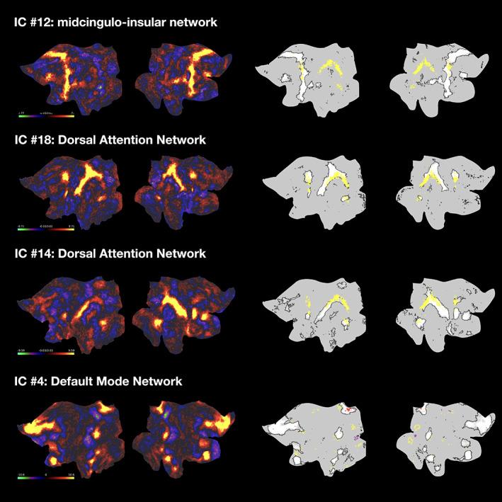 https://cdn.ncbi.nlm.nih.gov/pmc/blobs/89a5/8837576/27d1101f8d34/HBM-43-1431-g001.jpg