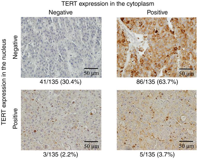 https://cdn.ncbi.nlm.nih.gov/pmc/blobs/89a6/8506680/b66eb4532650/mco-15-05-02406-g00.jpg
