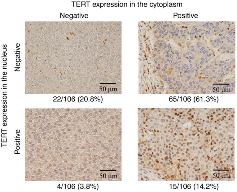 https://cdn.ncbi.nlm.nih.gov/pmc/blobs/89a6/8506680/d6252bf47ab5/mco-15-05-02406-g01.jpg