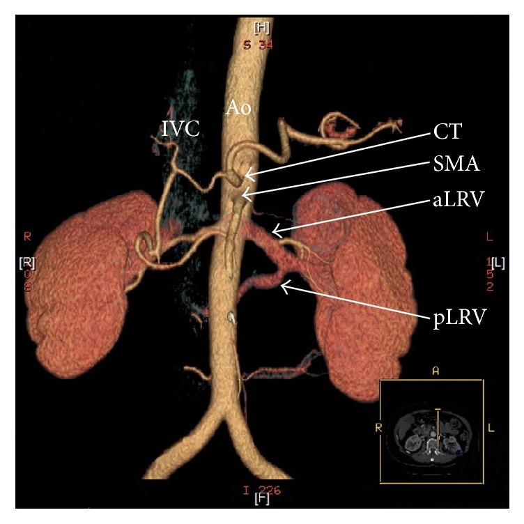 https://cdn.ncbi.nlm.nih.gov/pmc/blobs/89ae/5742442/048cd9319ce8/BMRI2017-1746570.004.jpg