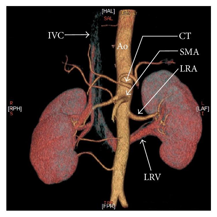 https://cdn.ncbi.nlm.nih.gov/pmc/blobs/89ae/5742442/b12092ceb8a4/BMRI2017-1746570.003.jpg