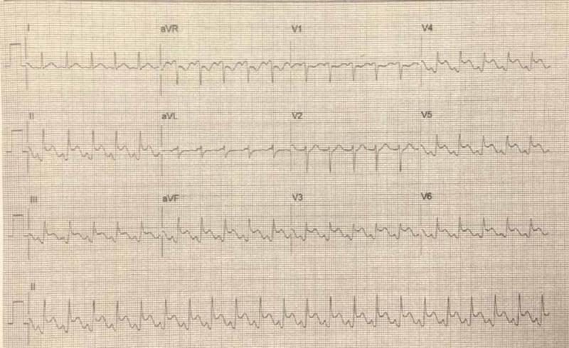 https://cdn.ncbi.nlm.nih.gov/pmc/blobs/89b8/7515549/2fa283d0e339/cureus-0012-00000010015-i03.jpg