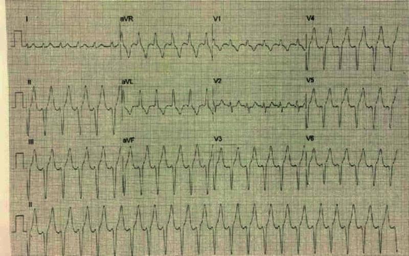 https://cdn.ncbi.nlm.nih.gov/pmc/blobs/89b8/7515549/52cf4f41713d/cureus-0012-00000010015-i02.jpg