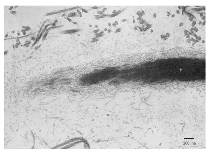 https://cdn.ncbi.nlm.nih.gov/pmc/blobs/89bb/5070419/940bc20bb7f8/CTE-5-113_F1.jpg