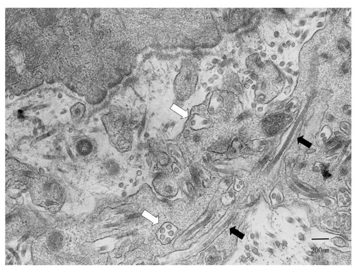 https://cdn.ncbi.nlm.nih.gov/pmc/blobs/89bb/5070419/e9b2e1e5ea62/CTE-5-113_F2.jpg