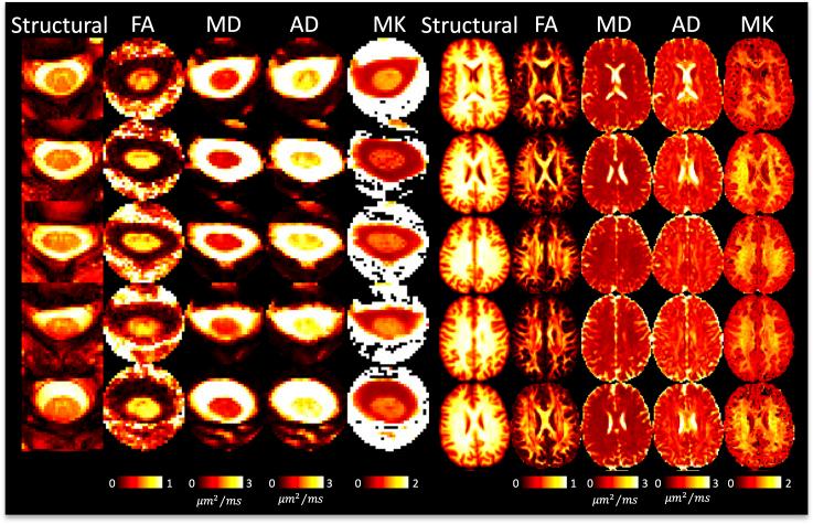 https://cdn.ncbi.nlm.nih.gov/pmc/blobs/89c6/12365691/25aeb0b53adf/IMAG.a.111_fig4.jpg