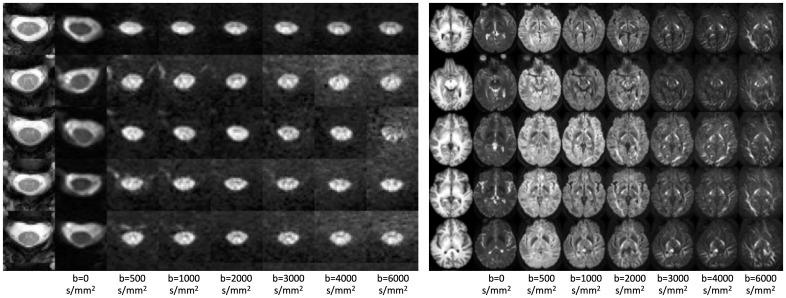 https://cdn.ncbi.nlm.nih.gov/pmc/blobs/89c6/12365691/37b515796335/IMAG.a.111_fig3.jpg