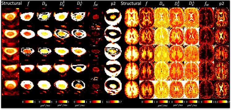 https://cdn.ncbi.nlm.nih.gov/pmc/blobs/89c6/12365691/8f4f5d82f638/IMAG.a.111_fig5.jpg