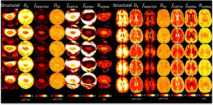 https://cdn.ncbi.nlm.nih.gov/pmc/blobs/89c6/12365691/ecf781e8c0fc/IMAG.a.111_fig6.jpg
