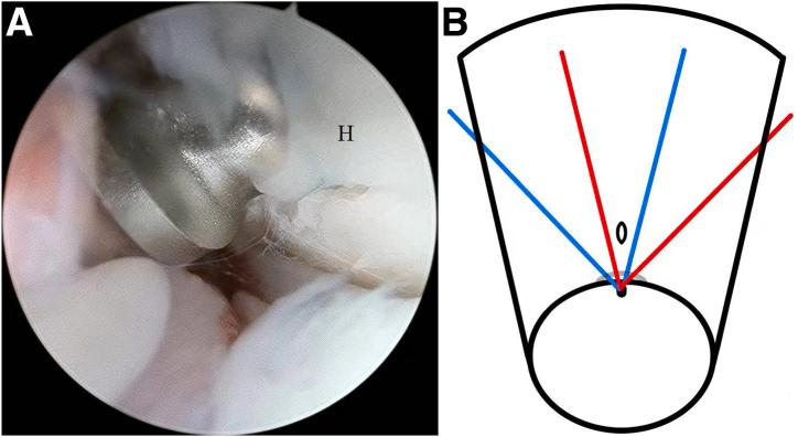 https://cdn.ncbi.nlm.nih.gov/pmc/blobs/89cd/11519960/09c404ca851d/gr3.jpg
