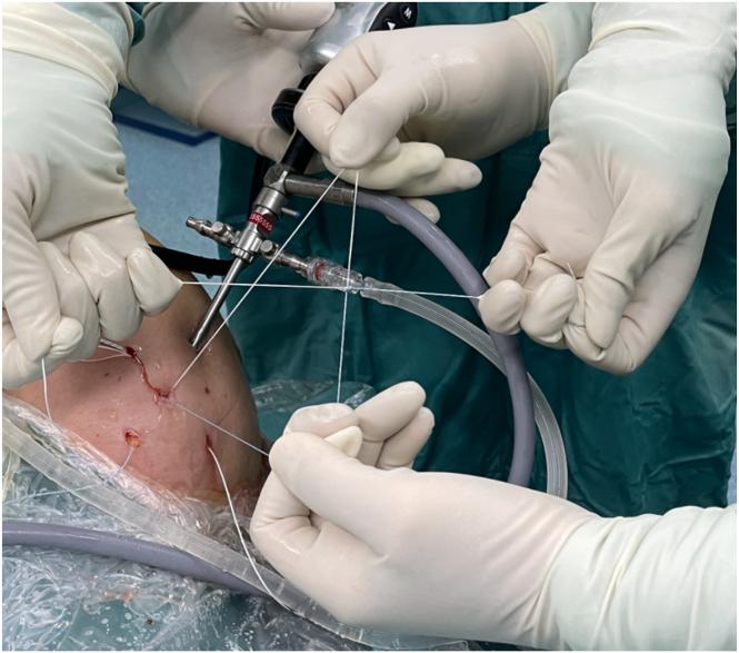 https://cdn.ncbi.nlm.nih.gov/pmc/blobs/89cd/11519960/7b27263b1927/gr9.jpg