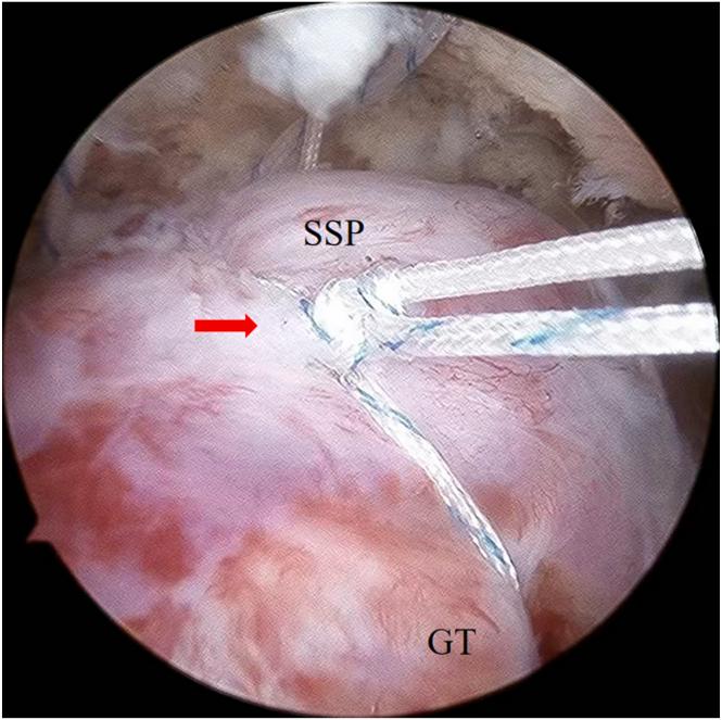 https://cdn.ncbi.nlm.nih.gov/pmc/blobs/89cd/11519960/80ac556d8929/gr11.jpg