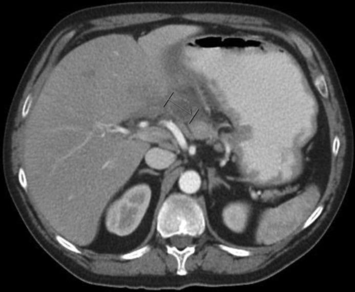 https://cdn.ncbi.nlm.nih.gov/pmc/blobs/89d3/5948316/1a048eda5517/CG-CGCR180022F002.jpg