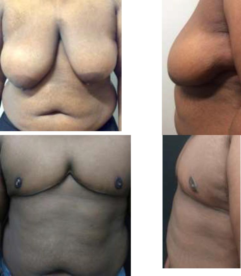 https://cdn.ncbi.nlm.nih.gov/pmc/blobs/89d4/8290439/cac031d6fc21/wjps-10-014-g001.jpg