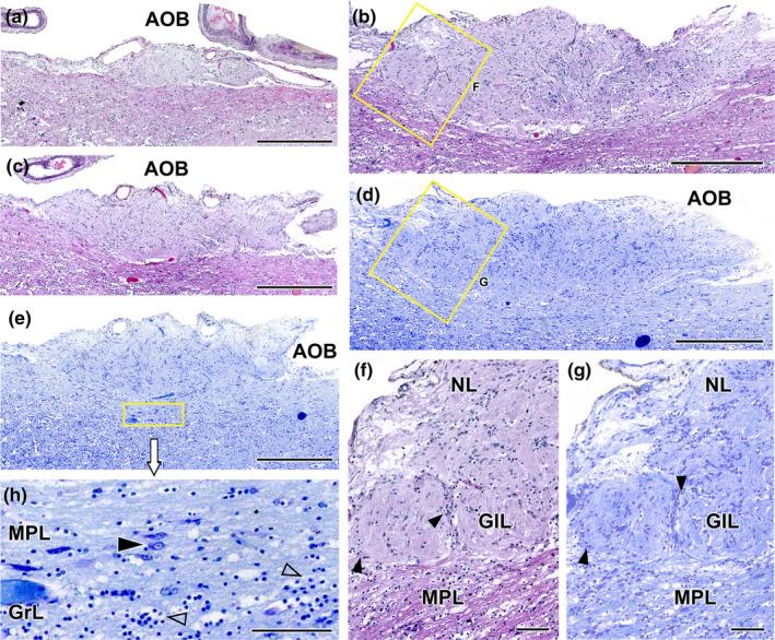 https://cdn.ncbi.nlm.nih.gov/pmc/blobs/89d8/11161832/8b93d101c6b7/JOA-245-109-g018.jpg