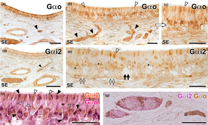 https://cdn.ncbi.nlm.nih.gov/pmc/blobs/89d8/11161832/8cfde6096cee/JOA-245-109-g008.jpg