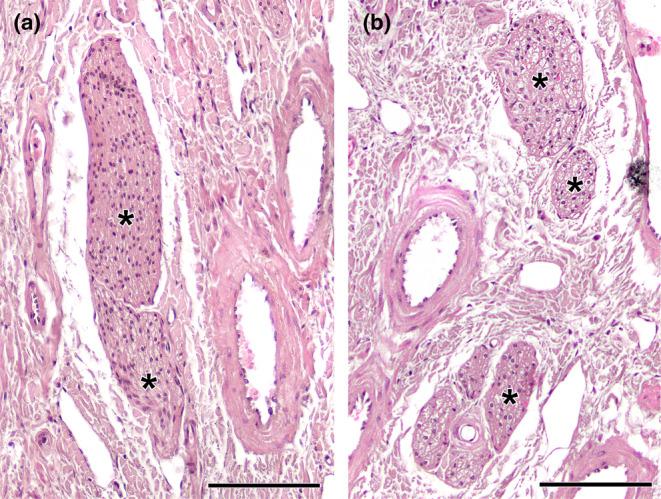 https://cdn.ncbi.nlm.nih.gov/pmc/blobs/89d8/11161832/aa63f740e96c/JOA-245-109-g016.jpg