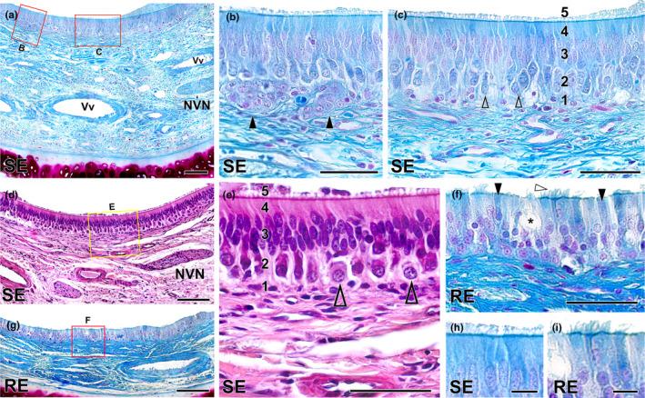 https://cdn.ncbi.nlm.nih.gov/pmc/blobs/89d8/11161832/cce551c413cd/JOA-245-109-g003.jpg