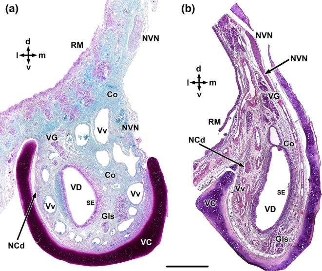 https://cdn.ncbi.nlm.nih.gov/pmc/blobs/89d8/11161832/fd4d5d6966ad/JOA-245-109-g004.jpg