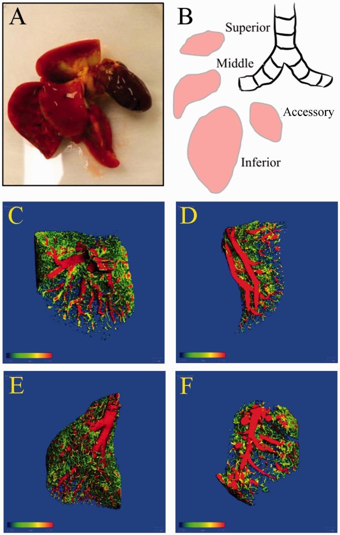https://cdn.ncbi.nlm.nih.gov/pmc/blobs/89de/5467946/9542ddd6cb9c/10.1177_2045893217709001-fig1.jpg