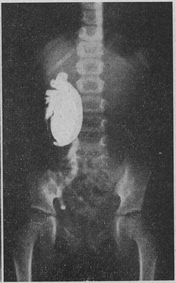 https://cdn.ncbi.nlm.nih.gov/pmc/blobs/89df/1814420/006ad5467672/brmedj02625-0040-c.jpg