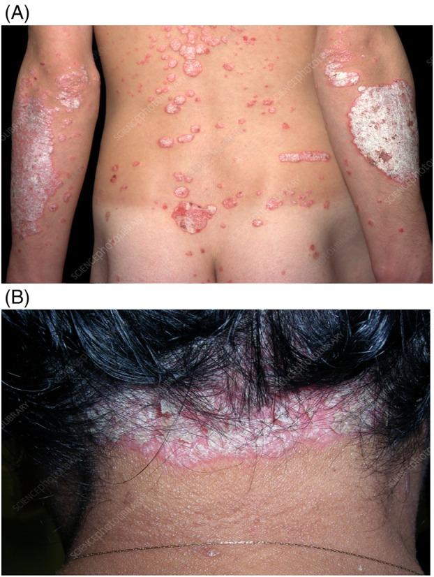 https://cdn.ncbi.nlm.nih.gov/pmc/blobs/89e0/12240009/42396fd69ab8/IMJ-55-1193-g001.jpg
