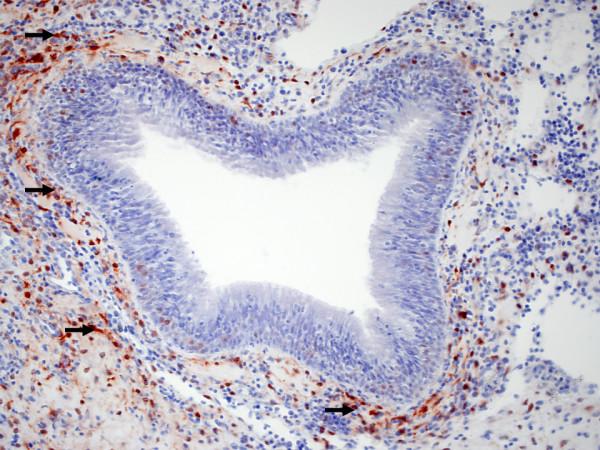 https://cdn.ncbi.nlm.nih.gov/pmc/blobs/89e0/2848203/c64ed88103ed/1471-2172-11-10-1.jpg