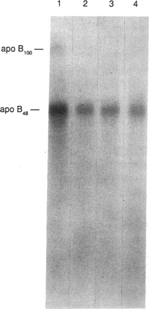 https://cdn.ncbi.nlm.nih.gov/pmc/blobs/89e1/288110/fb8724d2facd/jcinvest00039-0127-a.jpg