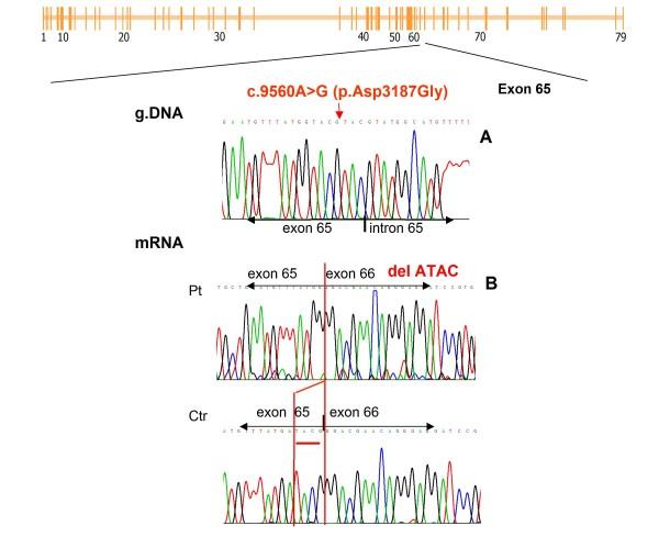 https://cdn.ncbi.nlm.nih.gov/pmc/blobs/89e4/3061890/58ea2d96ca4e/1471-2350-12-37-5.jpg