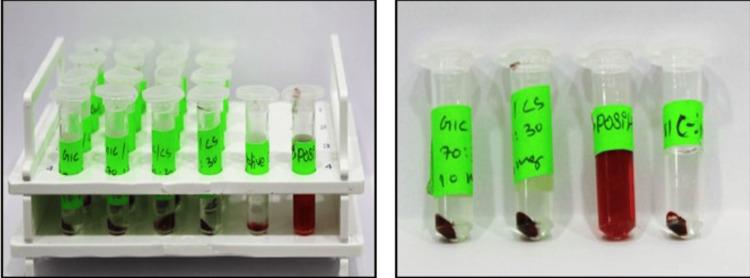 https://cdn.ncbi.nlm.nih.gov/pmc/blobs/89ed/10782189/9222d01dbc38/cureus-0015-00000050384-i04.jpg