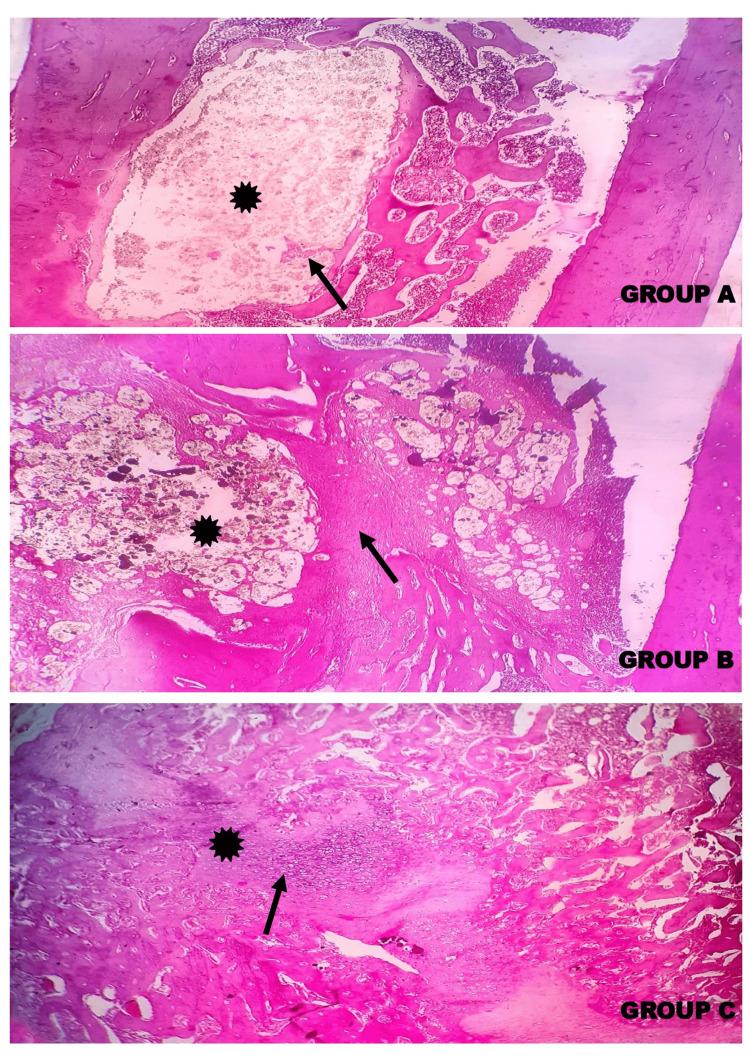 https://cdn.ncbi.nlm.nih.gov/pmc/blobs/89ed/10782189/aa78408c93fd/cureus-0015-00000050384-i13.jpg