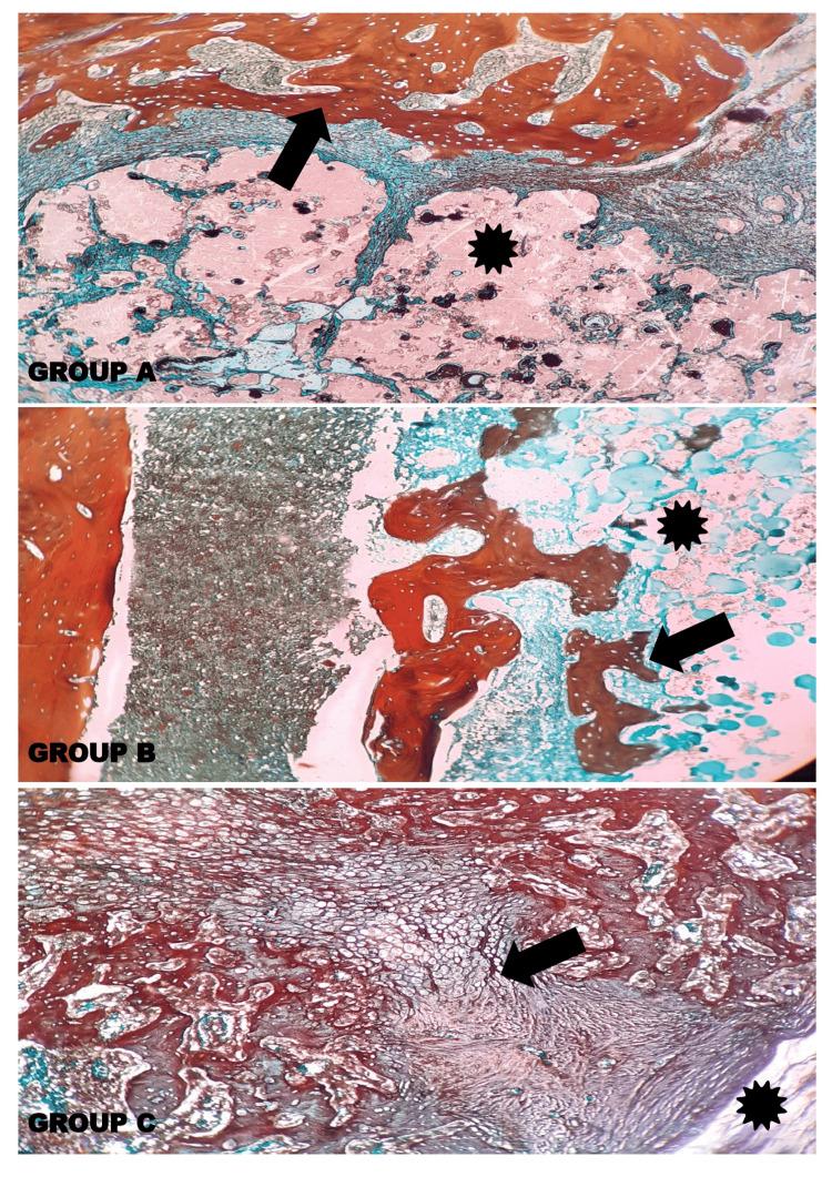 https://cdn.ncbi.nlm.nih.gov/pmc/blobs/89ed/10782189/ca0b30f19727/cureus-0015-00000050384-i15.jpg