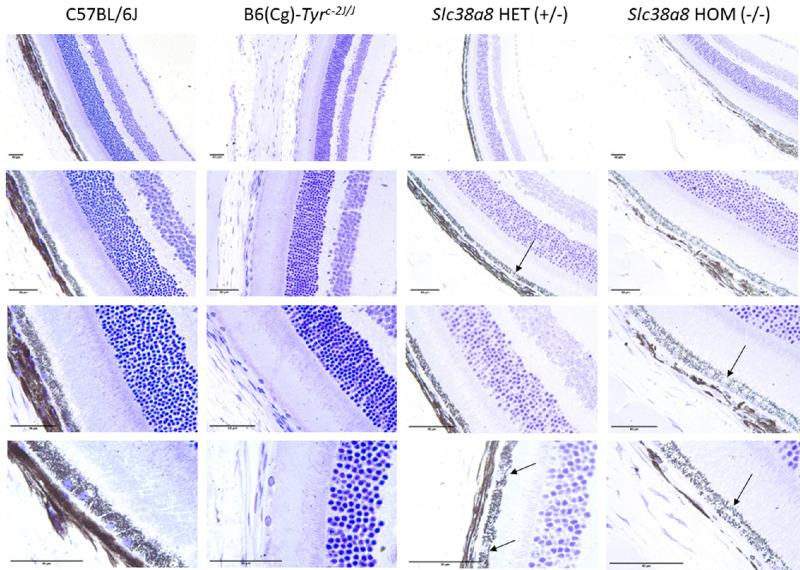 https://cdn.ncbi.nlm.nih.gov/pmc/blobs/89f1/10599165/a06c0c235e90/iovs-64-13-32-f004.jpg