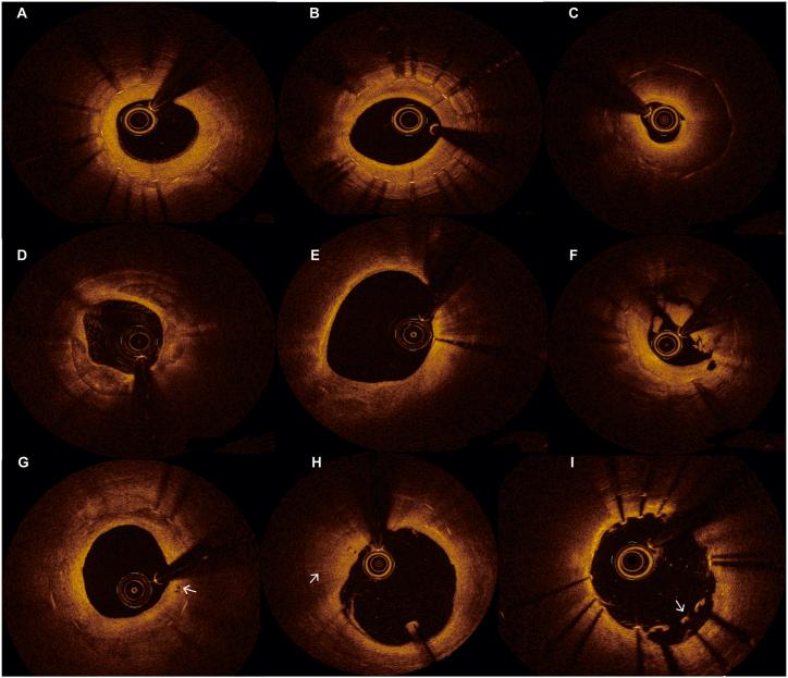 https://cdn.ncbi.nlm.nih.gov/pmc/blobs/89f1/11382084/ab4b1ff6784e/gr2.jpg