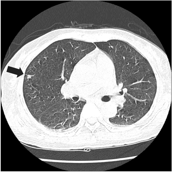 https://cdn.ncbi.nlm.nih.gov/pmc/blobs/89f6/4280384/de401f89a437/arm-38-852-g002.jpg