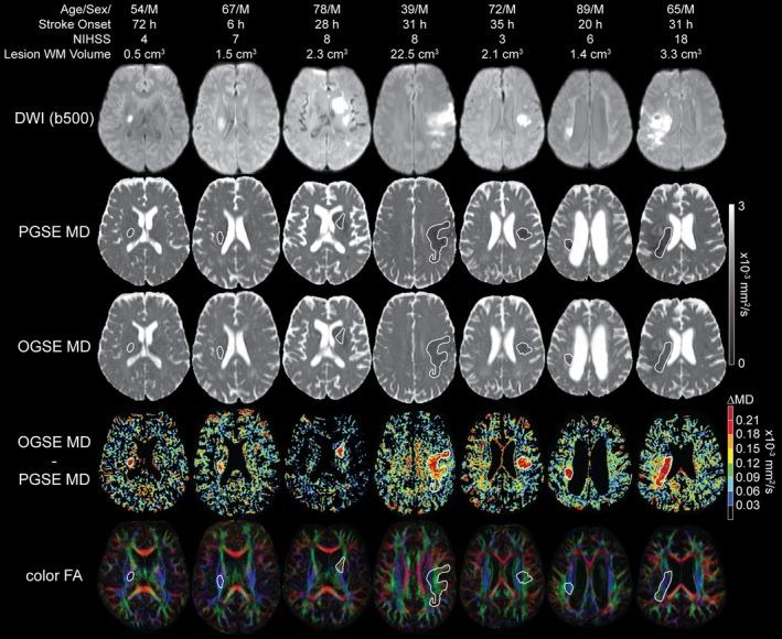 https://cdn.ncbi.nlm.nih.gov/pmc/blobs/89f7/12393189/672ad51ae165/MRM-94-2158-g003.jpg