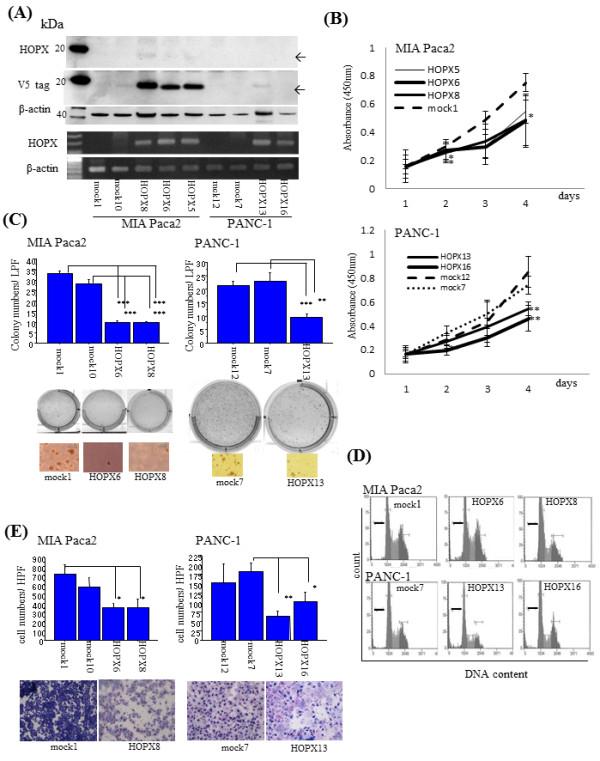 https://cdn.ncbi.nlm.nih.gov/pmc/blobs/89f7/3488580/63badd189562/1471-2407-12-397-5.jpg