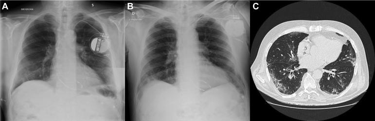 https://cdn.ncbi.nlm.nih.gov/pmc/blobs/89fa/7361181/aba3d5cf1c34/gr3.jpg