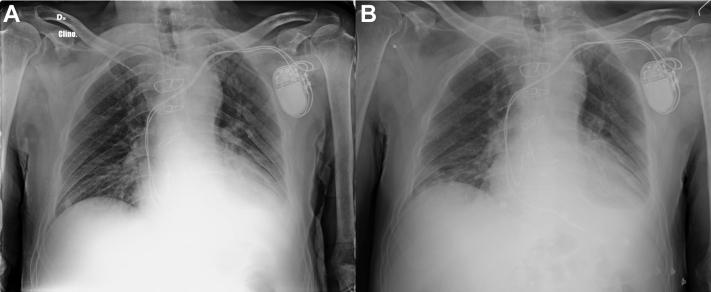https://cdn.ncbi.nlm.nih.gov/pmc/blobs/89fa/7361181/b5fb889645be/gr1.jpg
