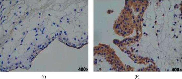 https://cdn.ncbi.nlm.nih.gov/pmc/blobs/89fb/9448610/481d0dc12955/CMMI2022-6283372.003.jpg