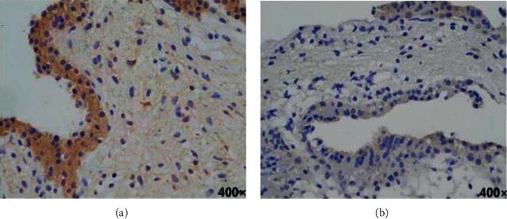 https://cdn.ncbi.nlm.nih.gov/pmc/blobs/89fb/9448610/613619626cb8/CMMI2022-6283372.002.jpg