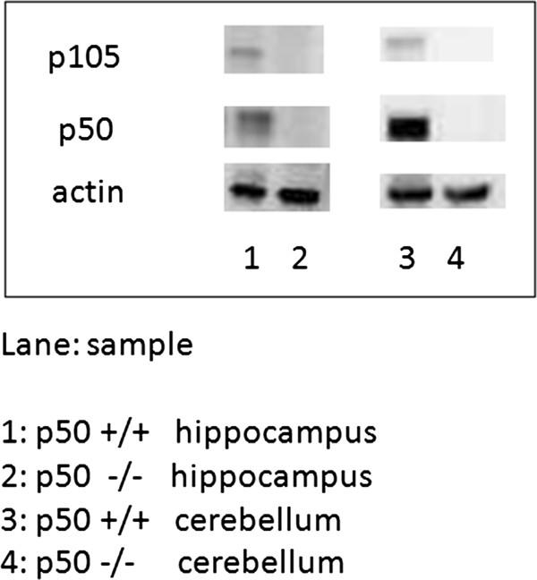 https://cdn.ncbi.nlm.nih.gov/pmc/blobs/8a00/3394209/b209647c5042/1471-2202-13-45-10.jpg