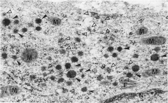 https://cdn.ncbi.nlm.nih.gov/pmc/blobs/8a00/460686/820c4e2a238b/thorax00255-0027-b.jpg