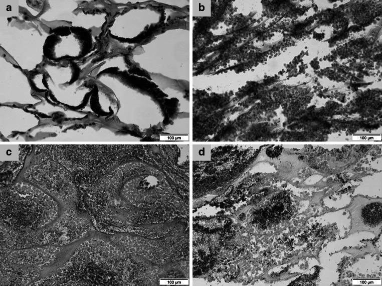 https://cdn.ncbi.nlm.nih.gov/pmc/blobs/8a00/4756037/5f598c78218f/10856_2016_5676_Fig1_HTML.jpg